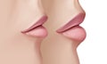 Realistic before and after vector illustration of woman having facial beauty botox injection. Lips closeup.