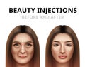 Realistic before and after vector illustration of woman having facial beauty injection.