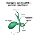 Rear spiral bending of the common hepatic duct. Pathology of the gallbladder.