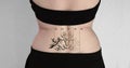 Rear View Of Laser Tattoo Removal Royalty Free Stock Photo