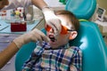 Reception at the dentistry. The dentist examines the oral cavity