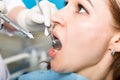 The reception was at the female dentist. Doctor examines the oral cavity on tooth decay. Caries protection. Tooth decay Royalty Free Stock Photo