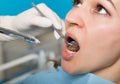 The reception was at the female dentist. Doctor examines the oral cavity on tooth decay. Caries protection. Tooth decay Royalty Free Stock Photo