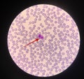 Red arrow showing neutrophil with toxic granule