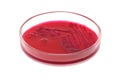 Red bacterial colonies on petri dish red agar isolated