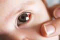 Red bloddshot eyes Royalty Free Stock Photo