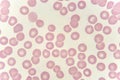 Red blood cells in blood smear Royalty Free Stock Photo