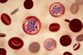 Red blood cells infected with malaria parasite Plasmodium vivax