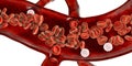 Red blood cells and leukocytes, cross-section of a blood vessel Royalty Free Stock Photo