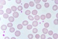 Red blood cells and platelet in blood smear Royalty Free Stock Photo