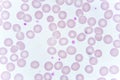 Red blood cells and platelet in blood smear