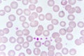 Red blood cells and platelet in blood smear Royalty Free Stock Photo