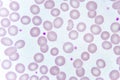Red blood cells and platelet in blood smear Royalty Free Stock Photo