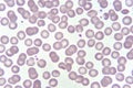 Red blood cells and platelet in blood smear Royalty Free Stock Photo