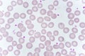 Red blood cells and platelet in blood smear Royalty Free Stock Photo