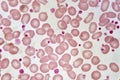 Red blood cells Royalty Free Stock Photo