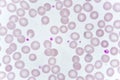 Red blood cells and platelet in blood smear Royalty Free Stock Photo