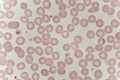 Red blood cells in blood smear Royalty Free Stock Photo