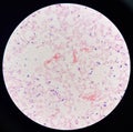 Red cell gram negative bacilli in hemo culture Royalty Free Stock Photo