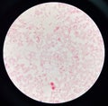 Red cell gram negative bacilli in hemo culture Royalty Free Stock Photo