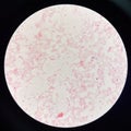 Red cell gram negative bacilli in hemo culture Royalty Free Stock Photo