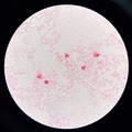 Red cell gram negative bacilli in hemo culture