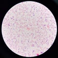 Red cell gram negative bacilli in hemo culture