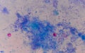 Red cells cryptosporidium oocyte