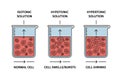 Red cells in isotonic hypotonic and hypertonic solutions Royalty Free Stock Photo