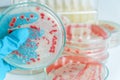 Red colony of becteria in petridish Royalty Free Stock Photo