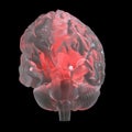 A red glowing glass brain