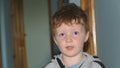 Red headed boy with purple eyes