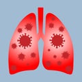 Human lungs infected with coronavirus