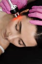 Red light of thermal or radio frequency on face of young woman for hardware RF lifting. Tightening and rejuvenation of Royalty Free Stock Photo
