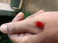 red mite on a human hand. Royalty Free Stock Photo