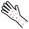 Red rash on human hand. Disease symptom icon