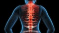 Red signal at spine area. This illustration about human back pain. Osteoarthritis concept Royalty Free Stock Photo