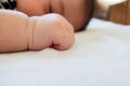 Red skin bump from mosquito bite on asian baby hand while sleeping in the bedroom. family and healthcare concept Royalty Free Stock Photo