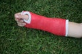 Red wrist arm and hand cast Royalty Free Stock Photo