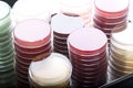 Red and yellow petri dishes stacks in microbiology lab on the bacteriology laboratory background.