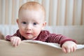 Redhead baby with atopic dermatitis Royalty Free Stock Photo