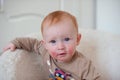 Redhead baby with atopic dermatitis