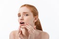 Redheaded woman shows fingers on acne on her face. Royalty Free Stock Photo