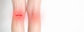 Redness and pain in the knee joints in a girl. White background, treatment of arthrosis and arthritis. Copy space for