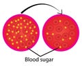 Reduce blood sugar level control