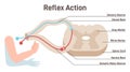 Reflex Arc anatomical scheme. Stimulus pathway in the spinal cord Royalty Free Stock Photo