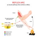 Reflex arc. A neural pathway that controls a reflex Royalty Free Stock Photo