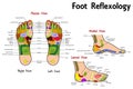 Reflexology Foot Chart Royalty Free Stock Photo