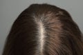 Regrown gray hair roots in a brunette. Age and stress. Close-up