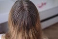 Regrown gray roots of dyed hair on head of woman. close-up